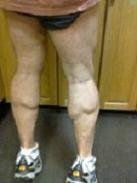 legs 11 22 11a.JPG