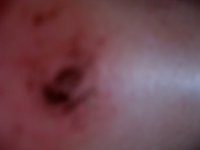 Wound exhibit #2 - fall from bike.jpg
