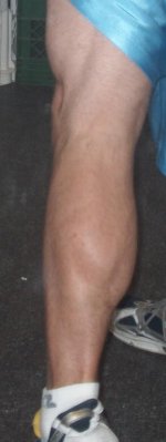 Lowwer Leg.JPG