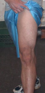 Upper Leg.JPG