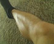 veiny lower leg 6-17-12.jpg