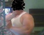 swollen injured arm for boards.JPG