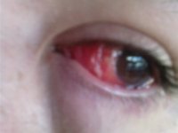 beat up.jpg