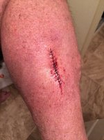 RS Calf.jpg