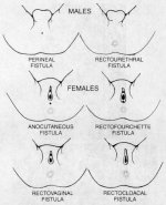 imperforate1.jpg