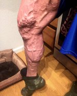 vascular legs.jpg